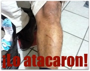 2 - 1 asaltado bateado y golpedo por pandilleros