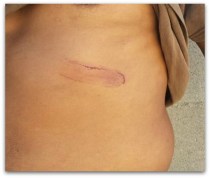 2 - 1 pedro jimenez agredido en la ballena