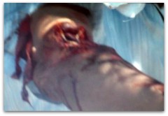 2 - 1 perro le arranco pedazo de brazo 333