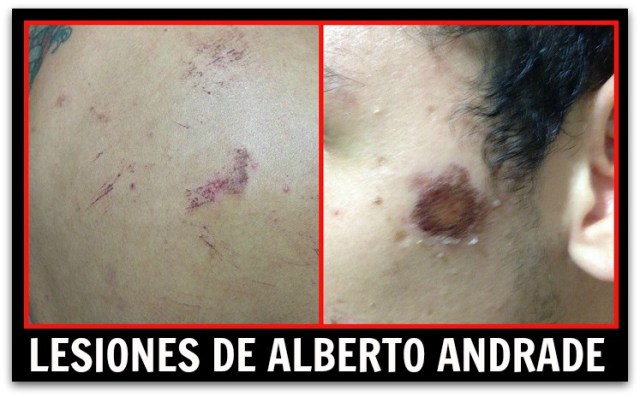 2 - 1 andrade tambien esta lesionado