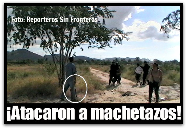 2 - 1 ballena atacaron con machete 2