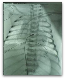 2 - 1 marca paso bebe salvatierra