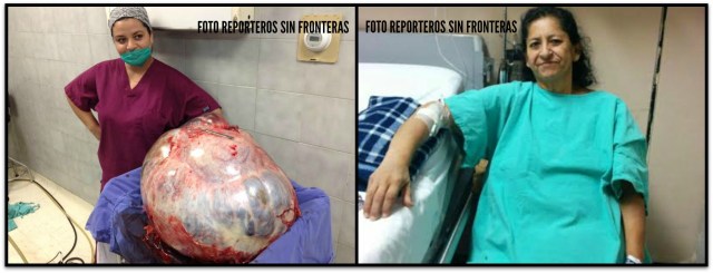 2 - 1 tumor cabo san lucas reporteros sin fronteras