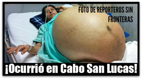 2 - 1 tumor imss cabo san lucas