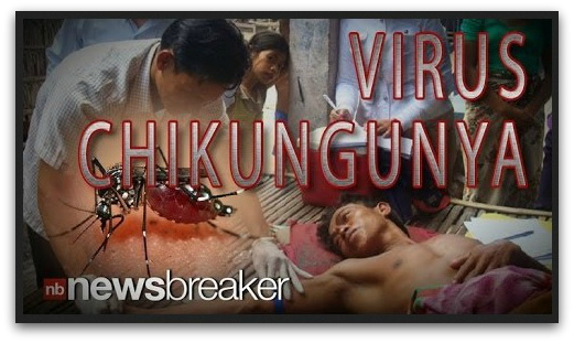 2 - 1 virus Chikungunya2