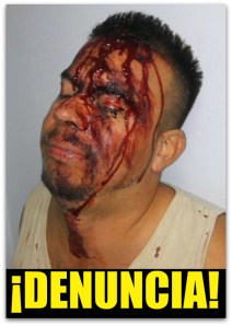 1 GOLPEADO POR OPERATIVO