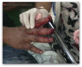 0 a dedos rebanados por trailer