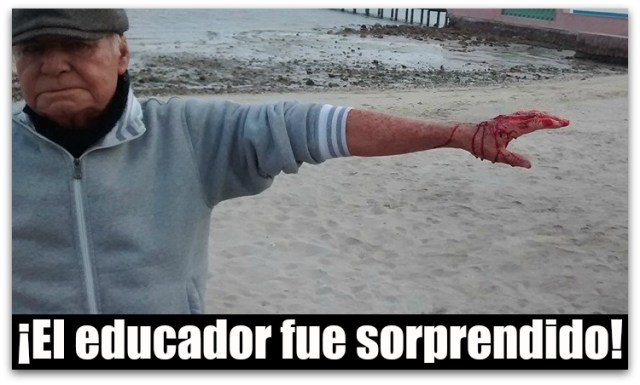 0 A A A ATACADO POR PERRO EN EL MALECON