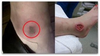 0 a araña violinista