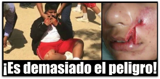 0 a a a recibio pedrada en el rosotro secundaria cabo san lucas