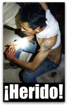 0 a a el anita centenario herido a balazos