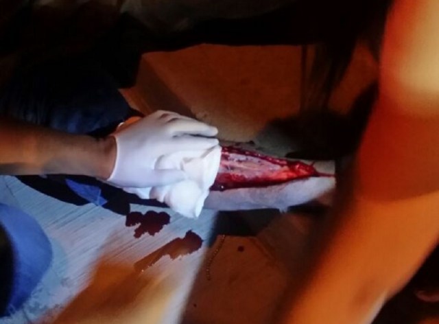 0-a-a-a-piel-calafia